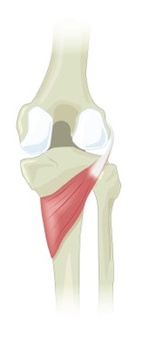 The popliteus muscle behind the knee, running from the outer thigh bone to the inner shin bone