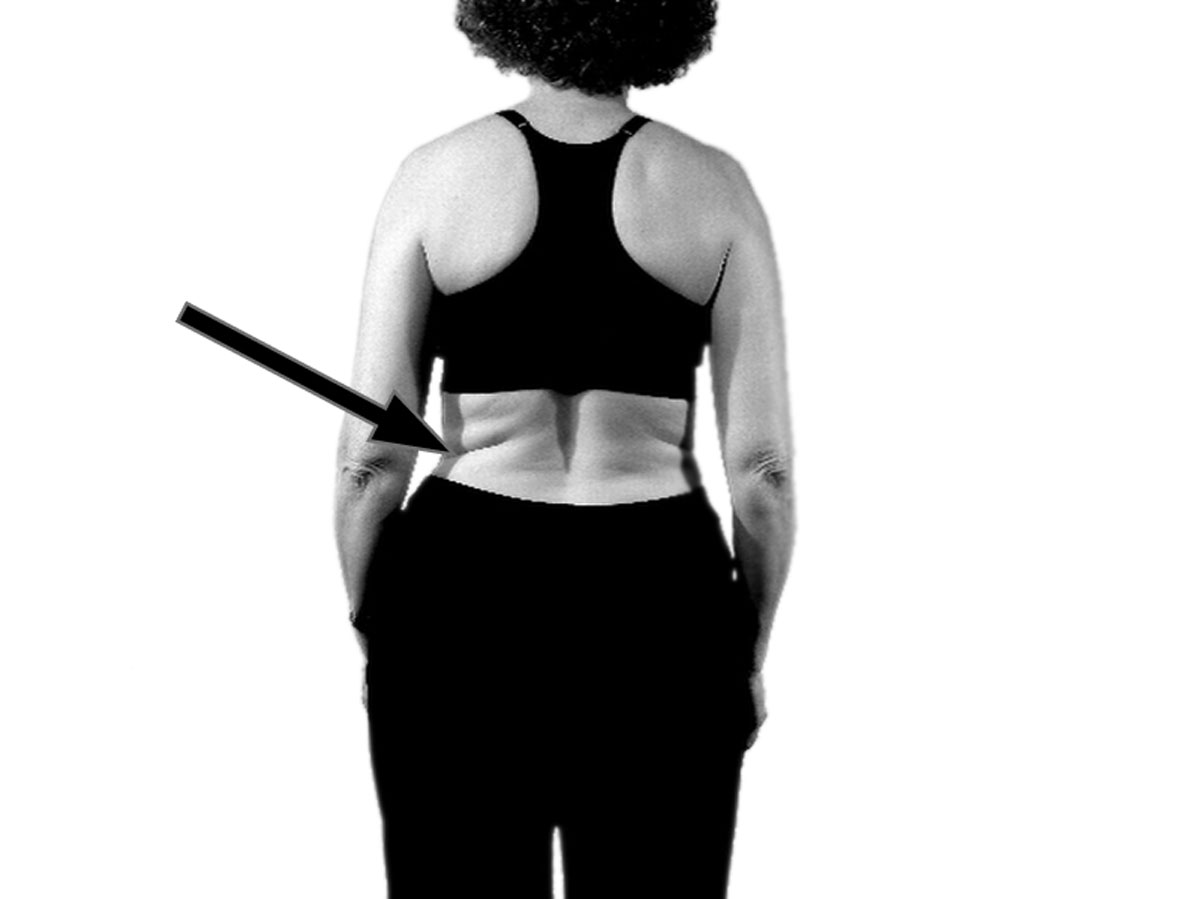 Bare back with an arrow pointing to a larger waist crease on the left side, with the pants sitting higher on the left hip