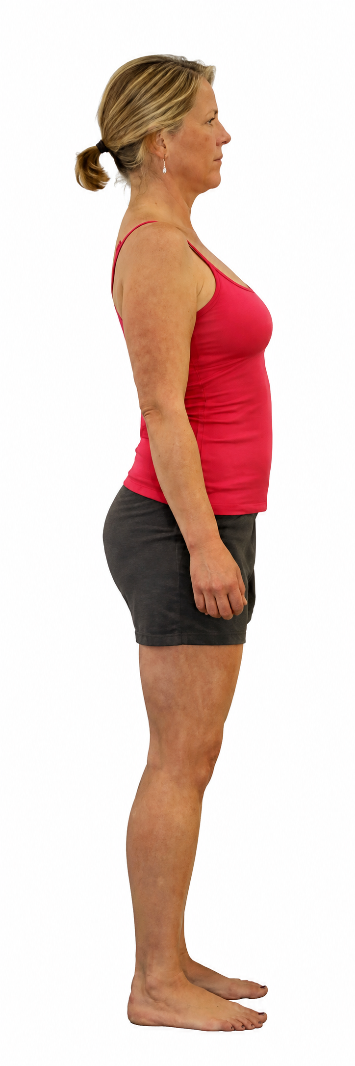 Side view of a woman with a habitually erect posture and an arched low back
